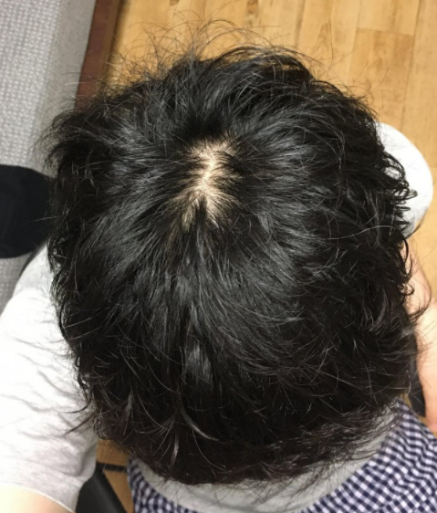 두파형_1~2단계_말린후.PNG