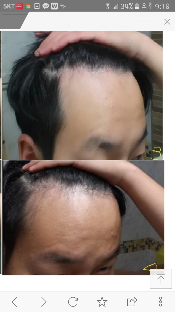 머릿사진20160223~2016년8월.png