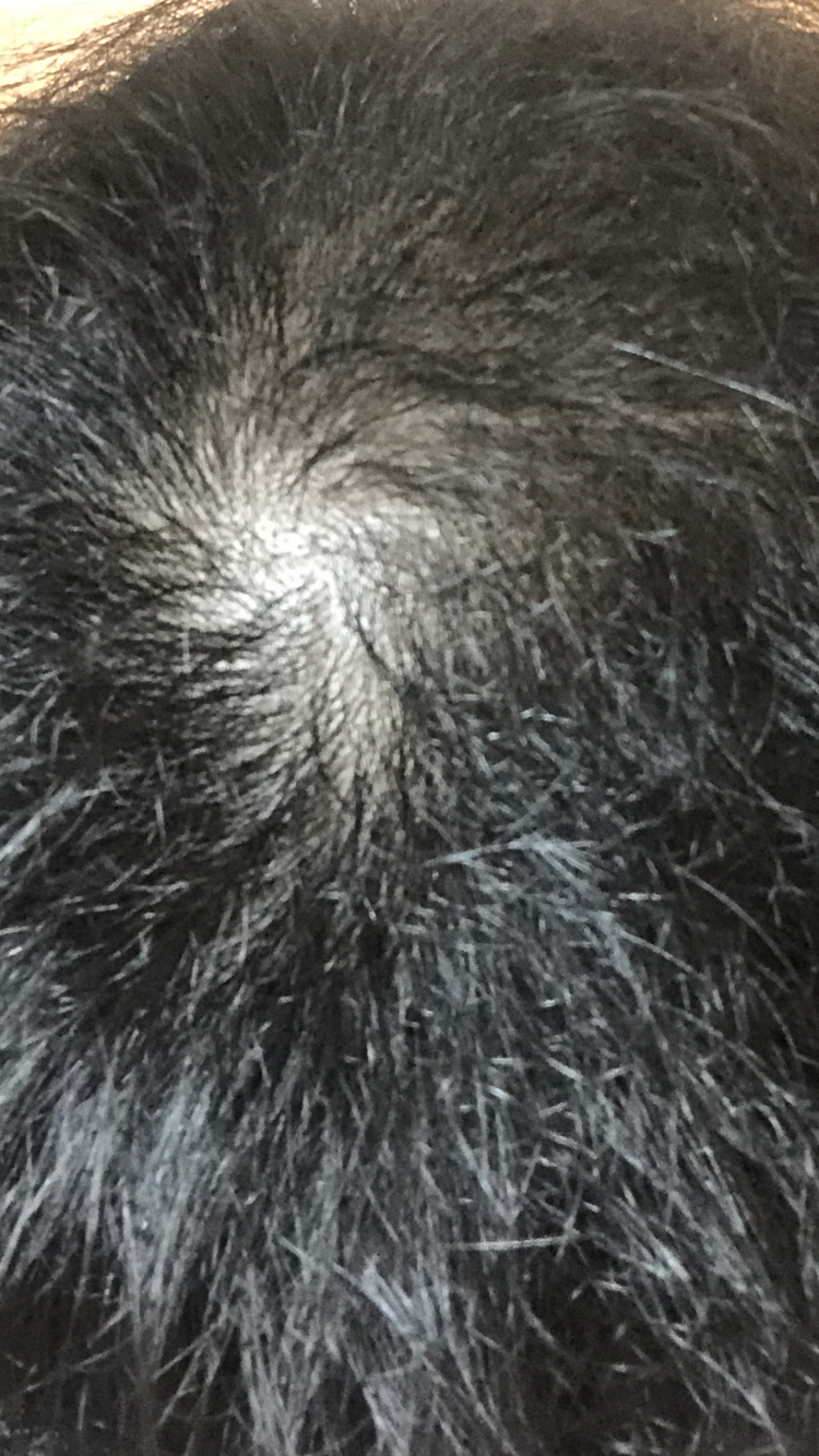 CC423C3A-CA14-4509-AAEC-1E6953A18172.png