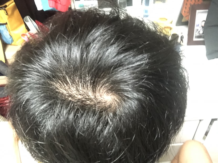 빛에 비췄을때