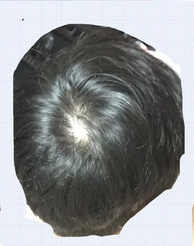 image.jpg