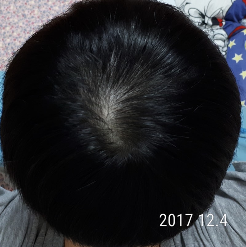 20171204_235149.jpg