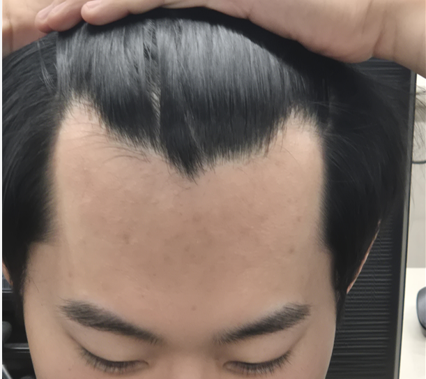M자인가요.png