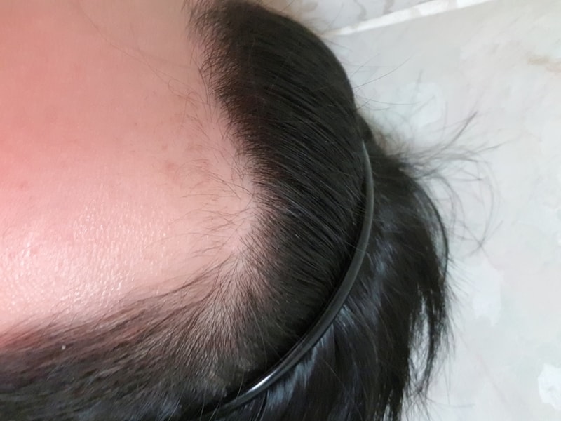 20180111_195340.jpg