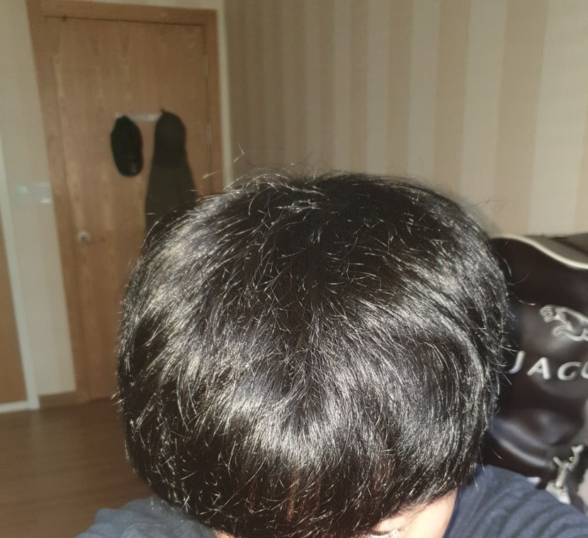 윗머리