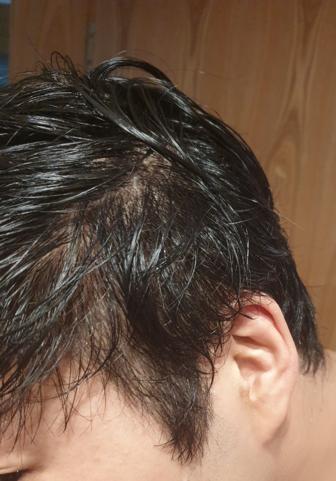 머리감고 옆머리2