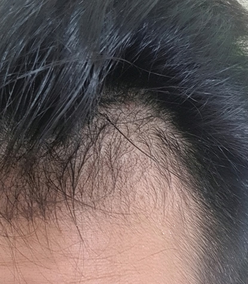 하나더.