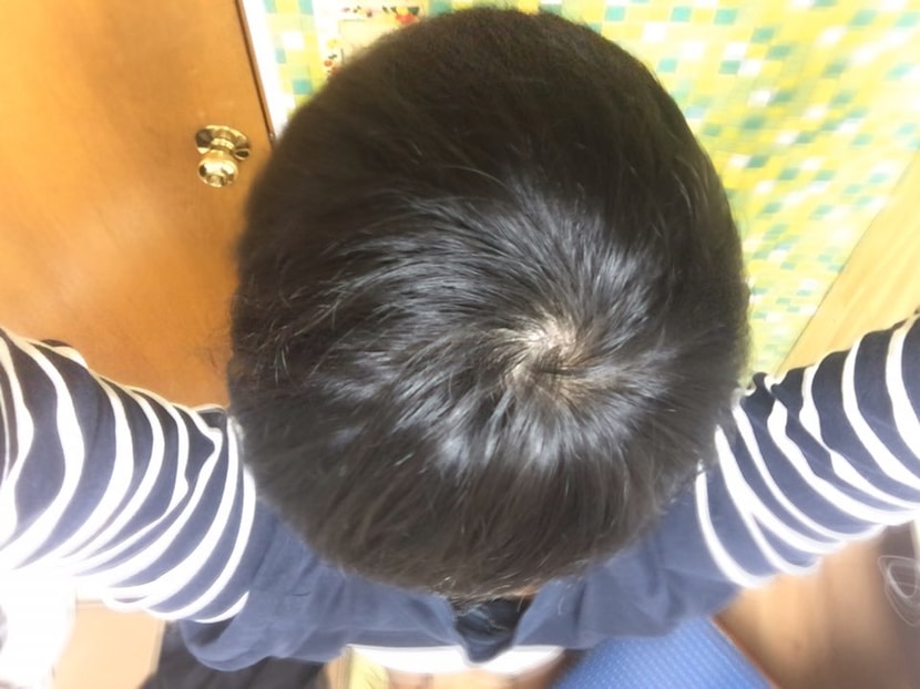 오늘 정수리 1
