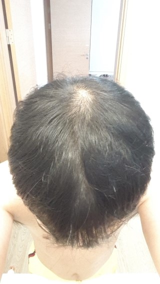 %BB%E7%BF뼼%B4%DE%C8%C4.jpg