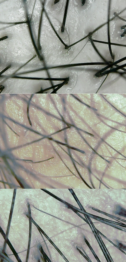두피1.gif