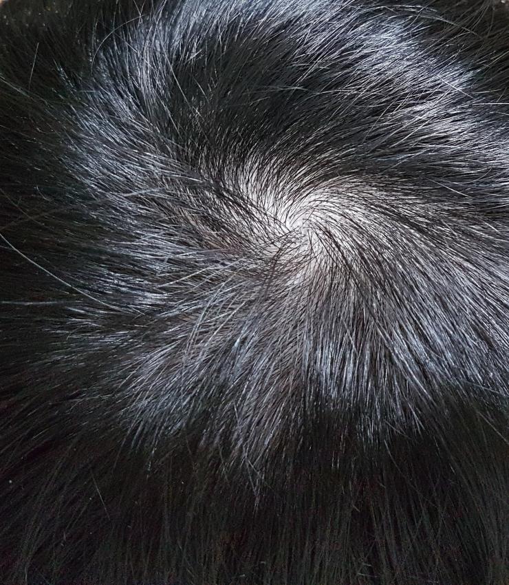 18년 3월.jpg