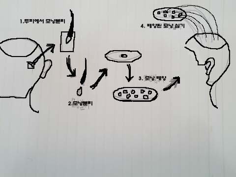 모낭사진.jpg