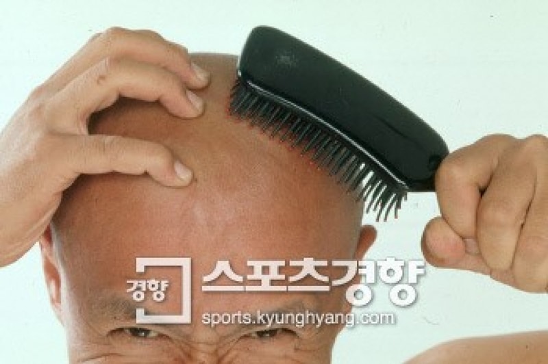 대머리.jpg