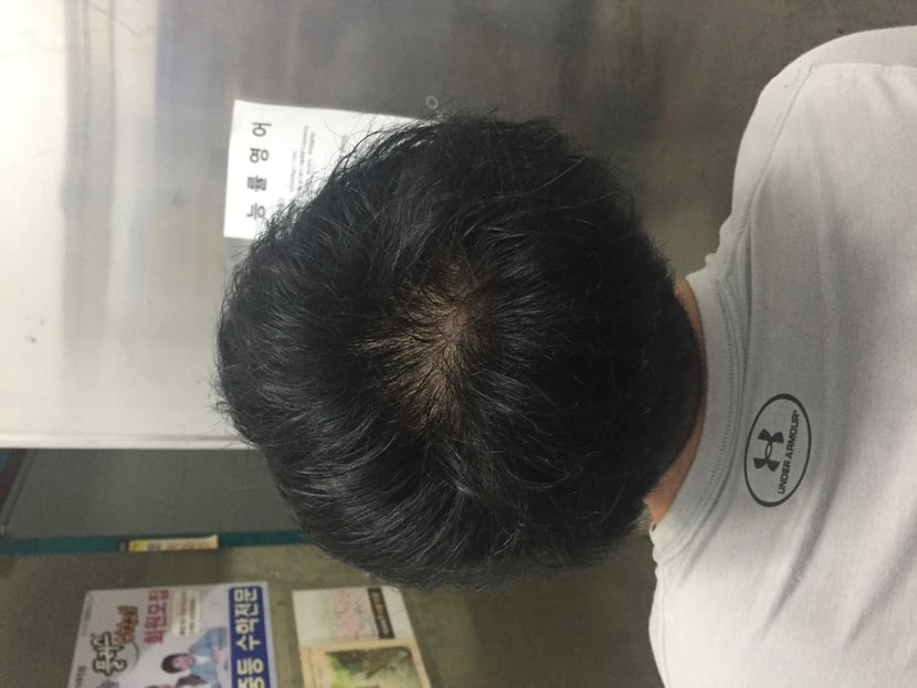 살면서 쭉해온 가르마방향