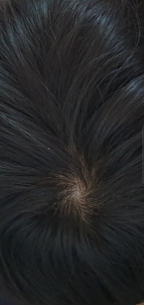 Screenshot_20190418-114743_Gallery.jpg