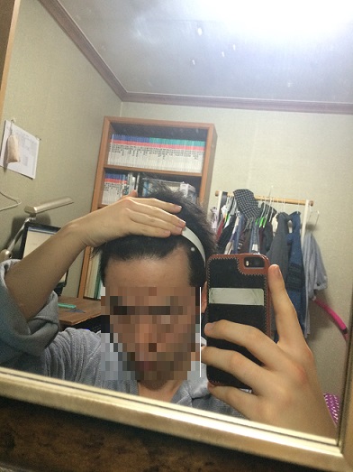 우측