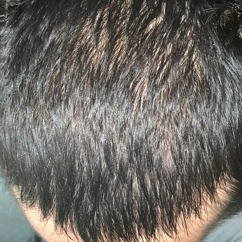 킨거