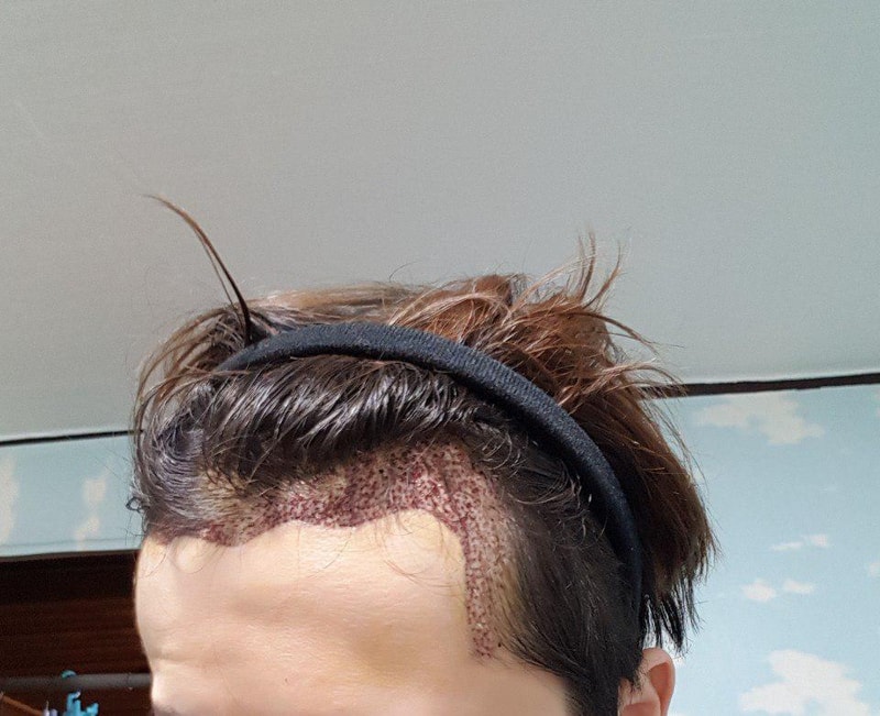 나는 앓아 (3).jpg