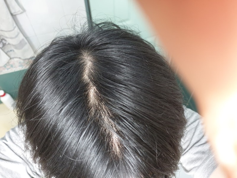 정수리.jpg