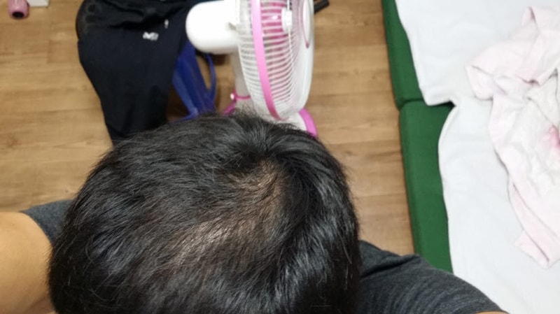정수리3.jpg