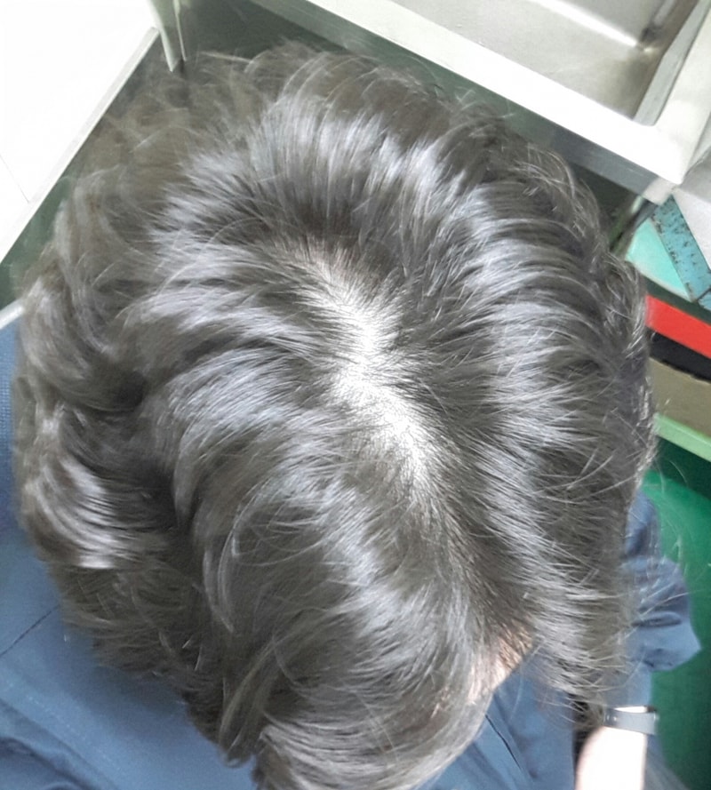 20170323_110818.jpg