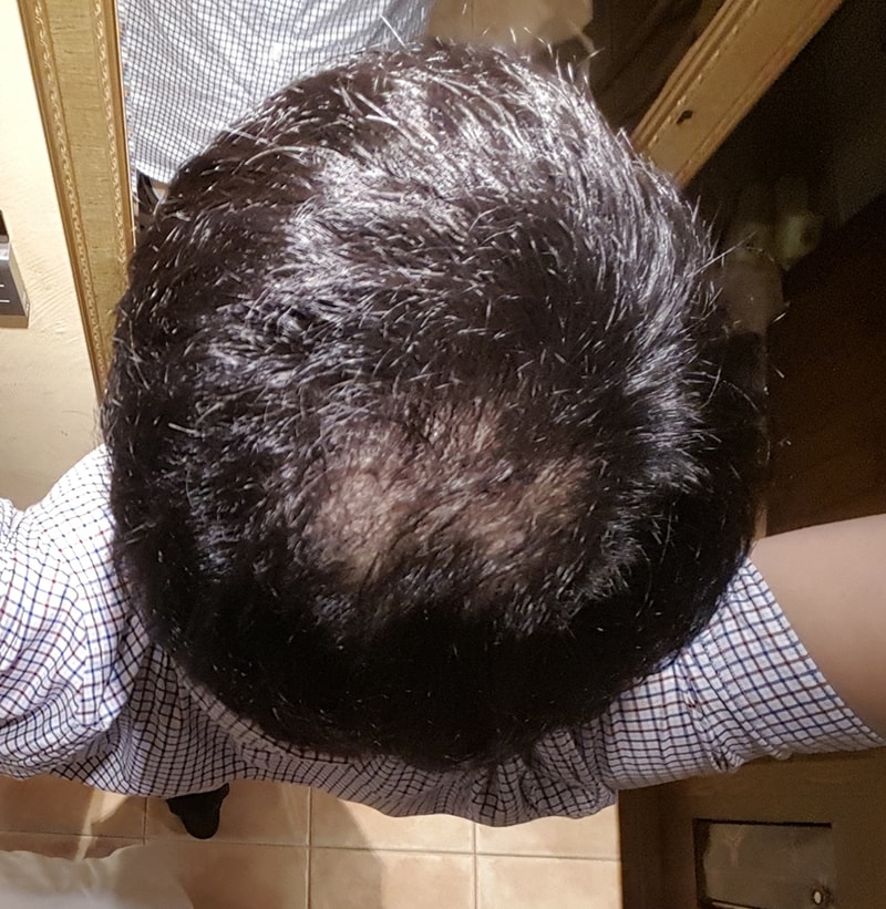BeautyPlus_20160802133117_save.jpg