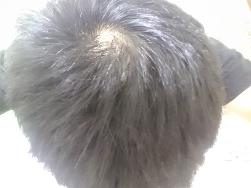 20170222_005532.jpg