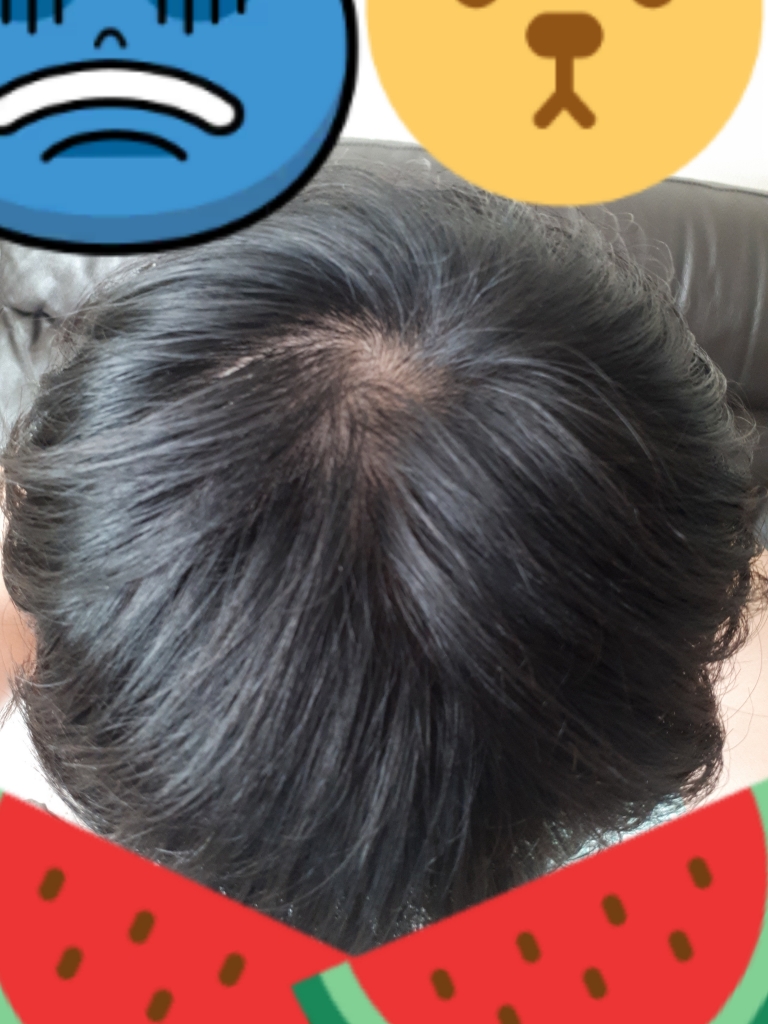 20180925_081831.jpg