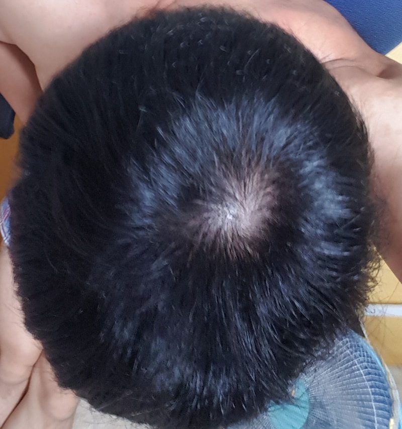 20170730_201226.jpg