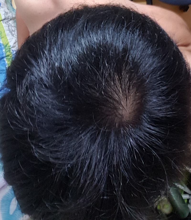 20170730_201259.jpg