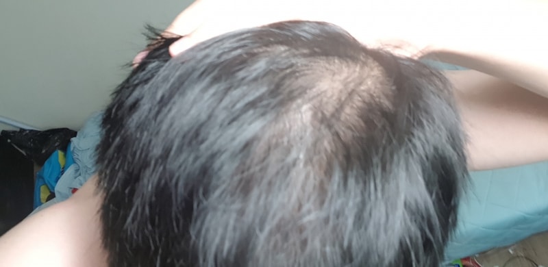 20180811_102450.jpg