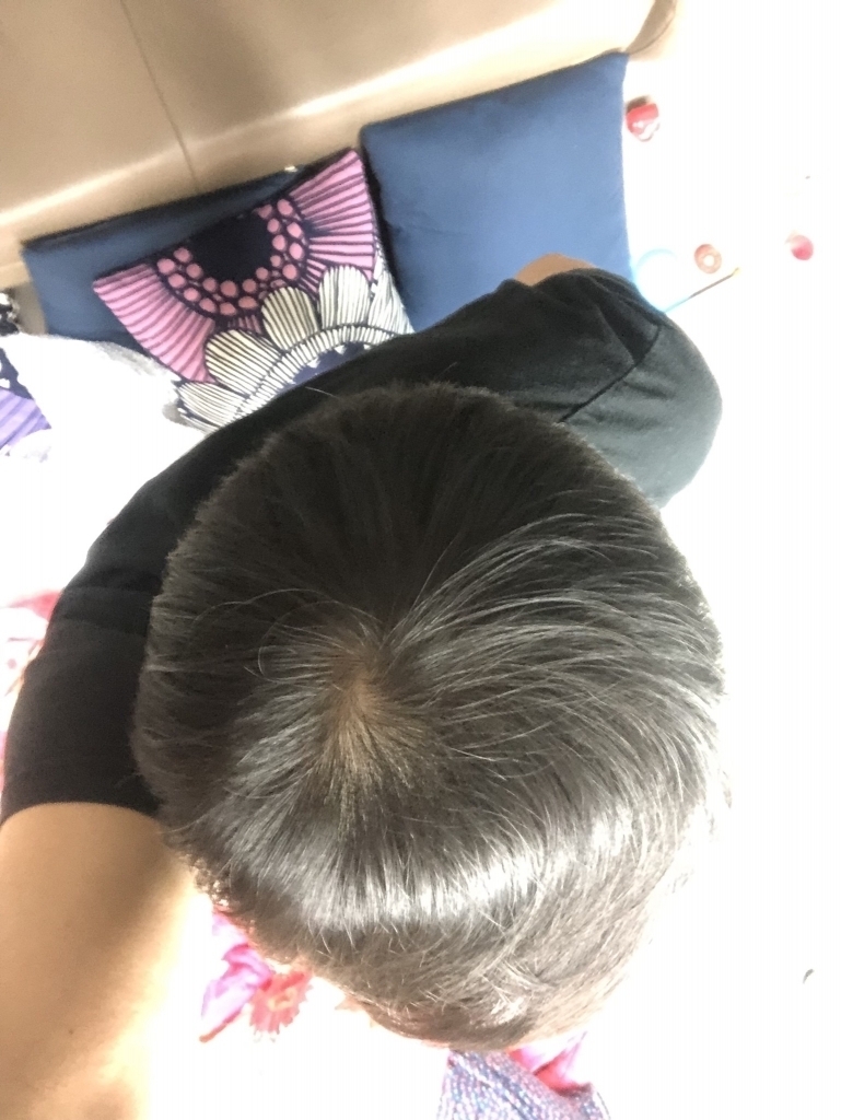 19. 3. 1.  복약 4개월