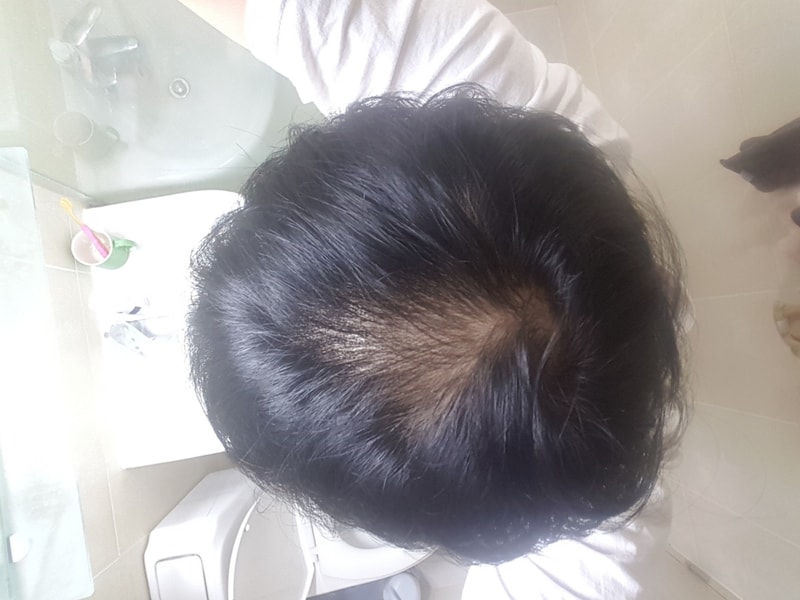 20180306_213109.jpg