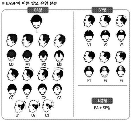 9F6CA1B5-5C87-45B8-A32B-28937B634ED9.png