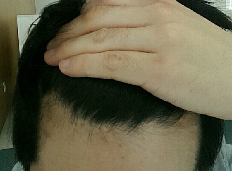 1493091335636.jpg