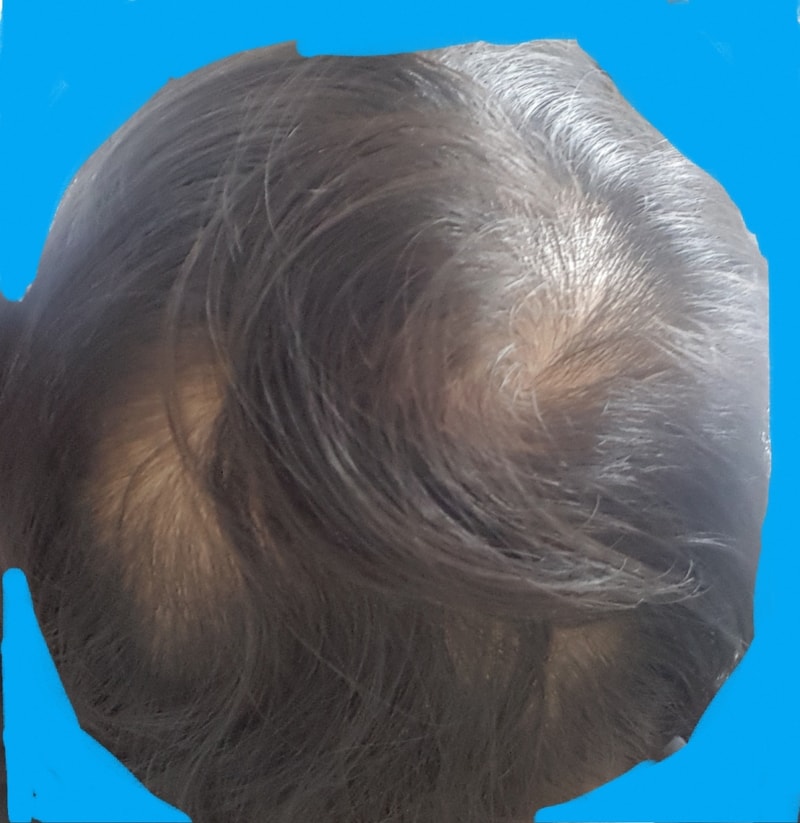 20170403_194601.jpg