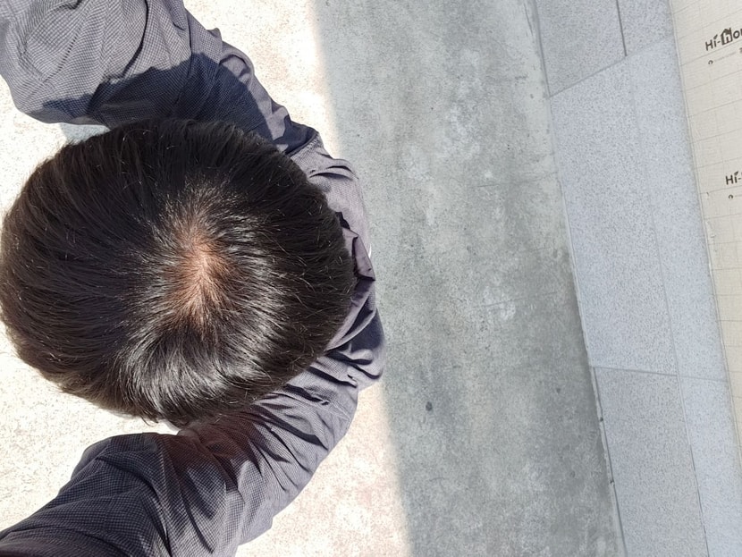 오후 강한 햇빛 아래