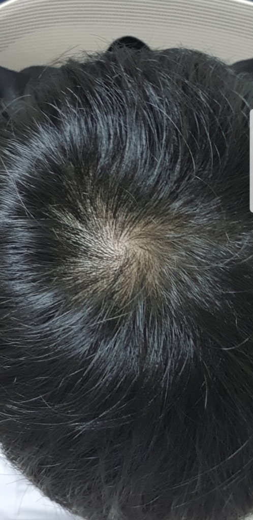 Screenshot_20180716-005931_Gallery.jpg