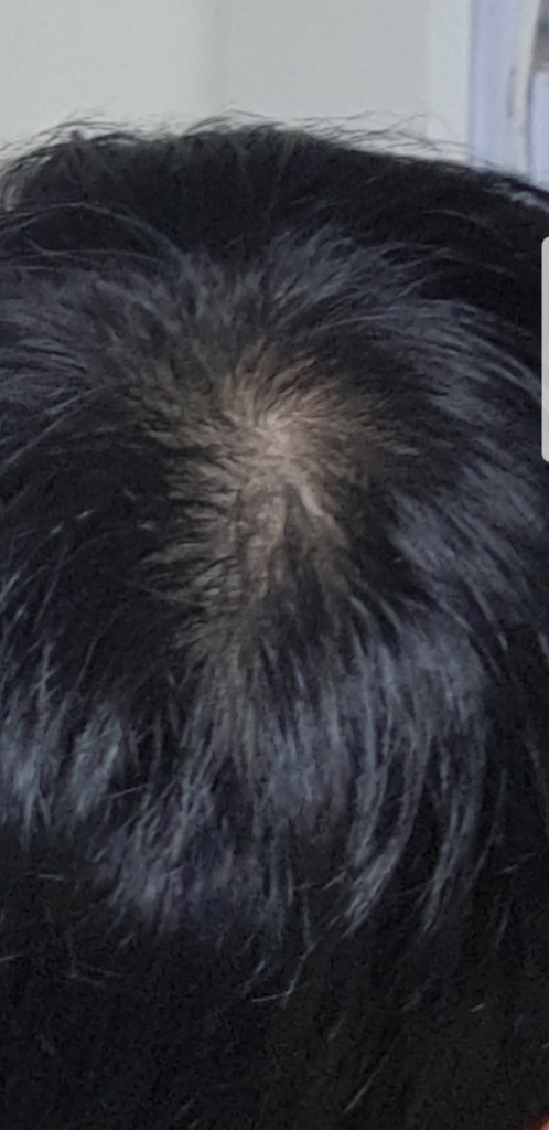 Screenshot_20180716-005943_Gallery.jpg