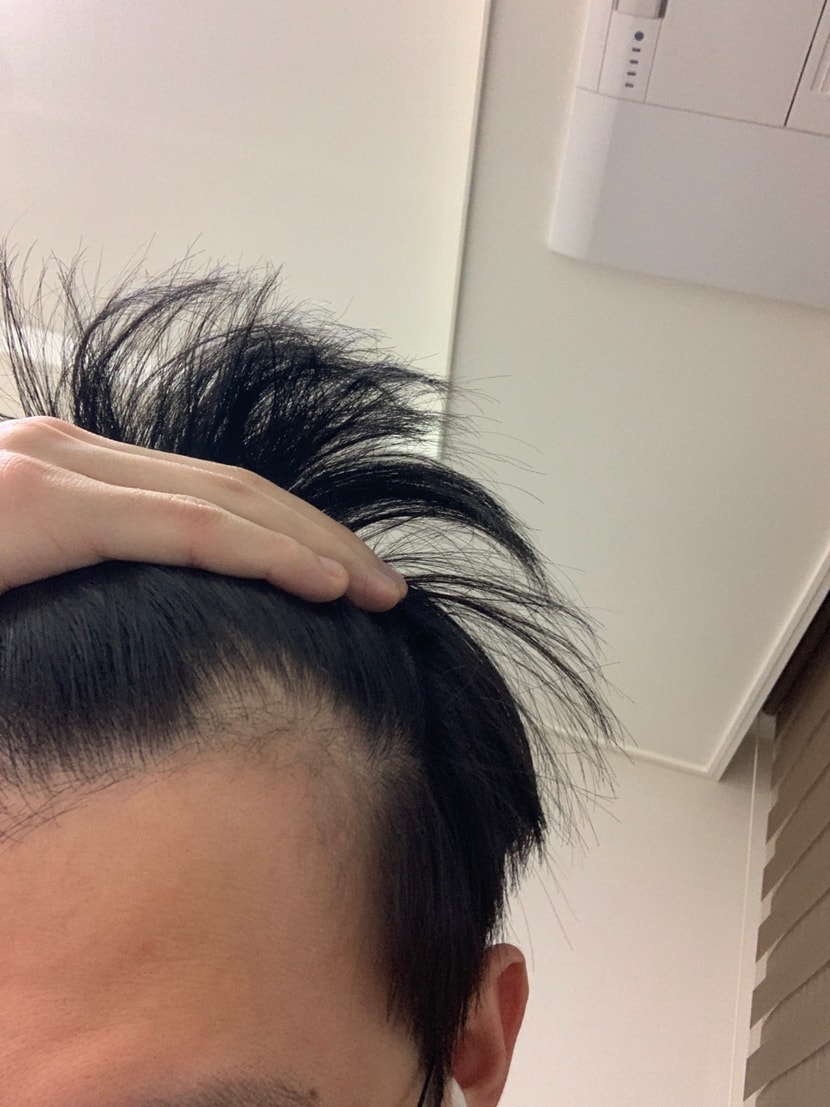 현재 왼쪽