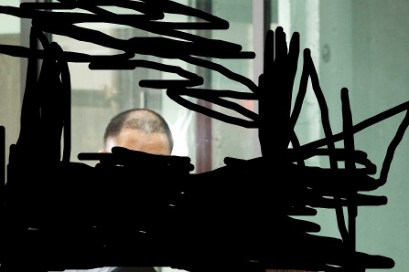 모발이식.jpg
