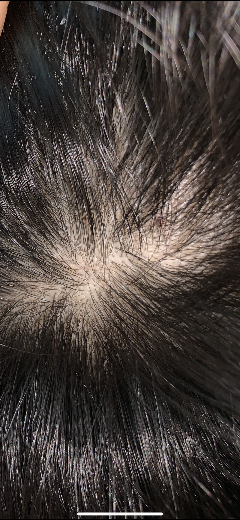 F50D7AA0-EF17-4B2C-B230-49A67D0561B9.png