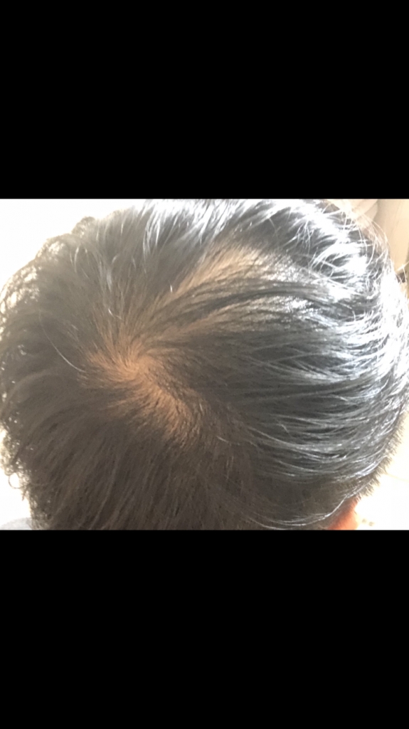 C038700F-D151-46FC-9DFA-54F630630BA4.png