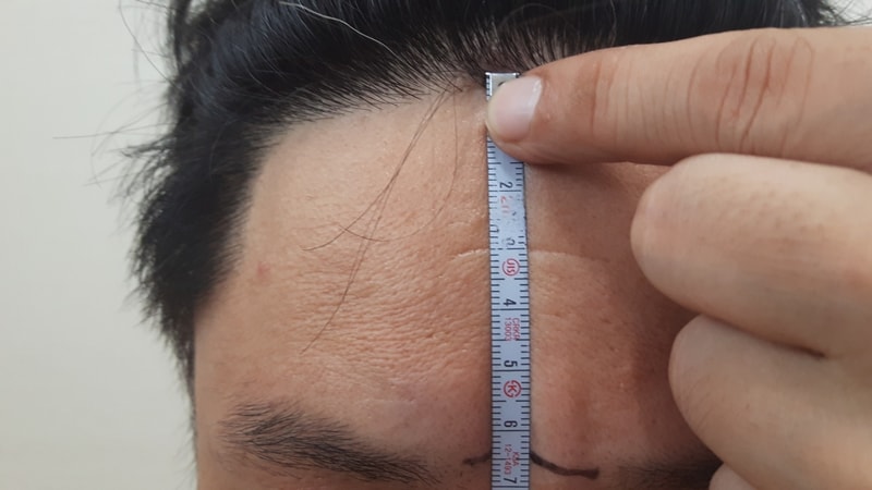 이마높이 6.5cm 2019.08.01.jpg