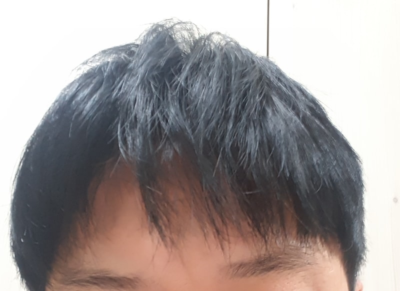 20200307_192658 로게인폼 1년 5개월 앞머리내림.jpg