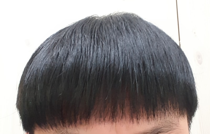로게인폼 5개월 1주.jpg