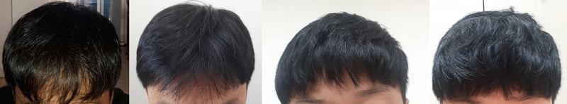 모재성 1년8개월 앞머리 갈라짐.jpg
