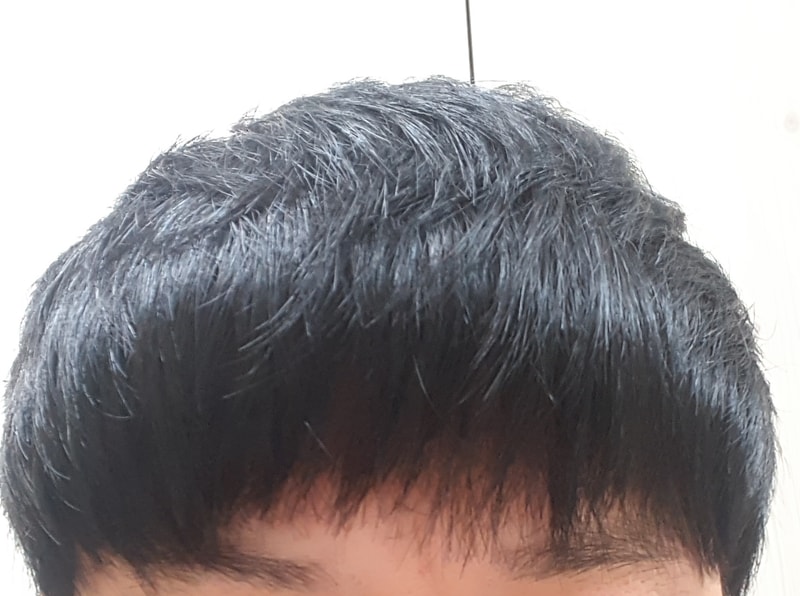 로게인폼 6개월.jpg