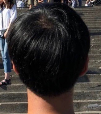 2018뒷통수.jpg