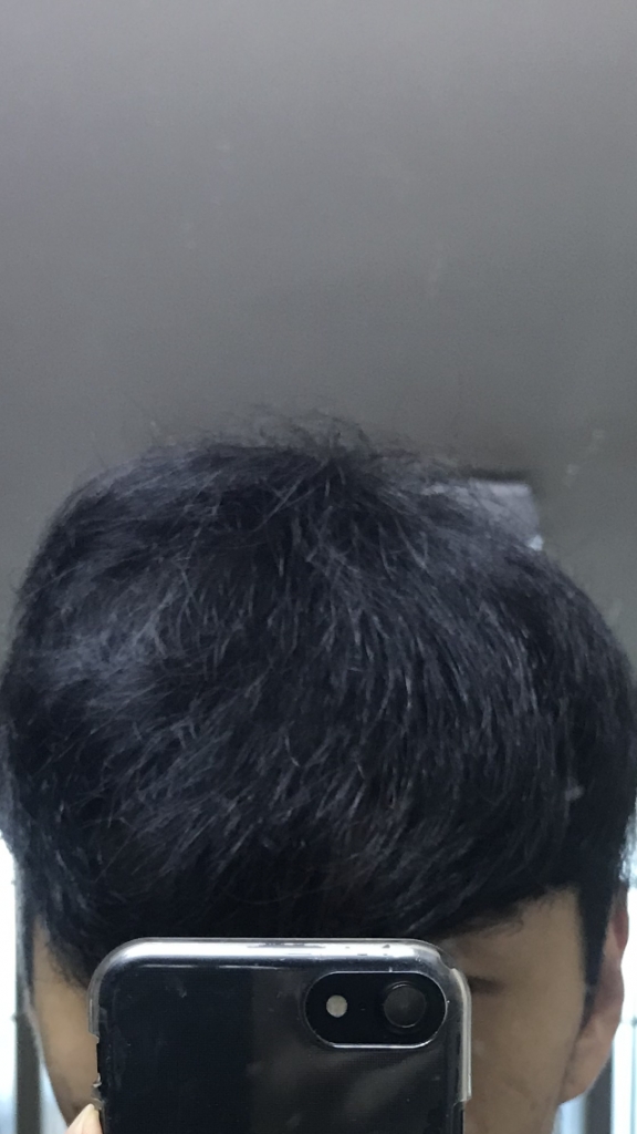 794C6824-1983-4FFB-A901-F3D8C0883DFC.png